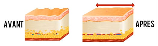Masque ChiUp Peau Avant Apres